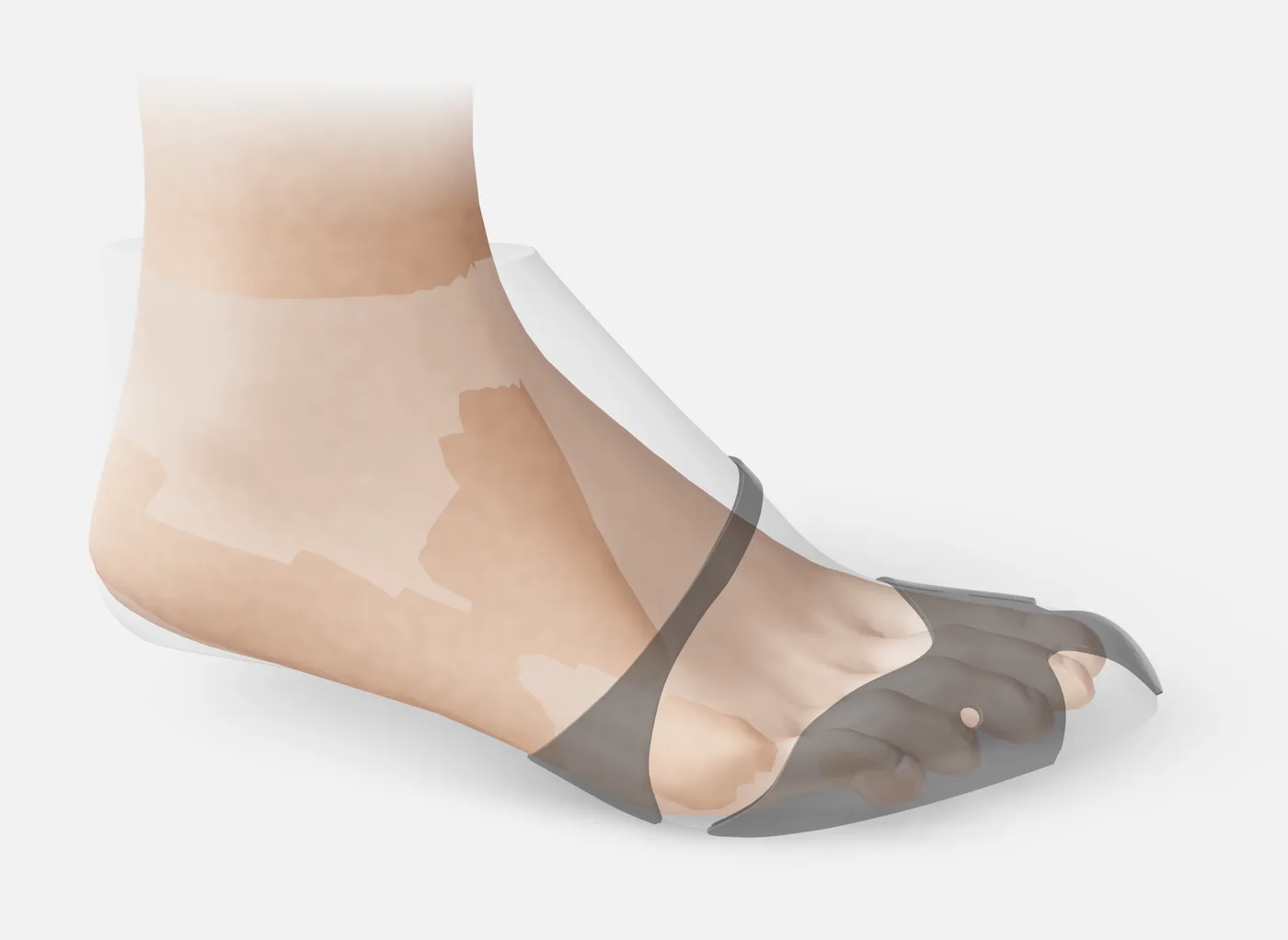 The foot of the size inside IGNES